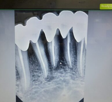 Best root canal treatment center