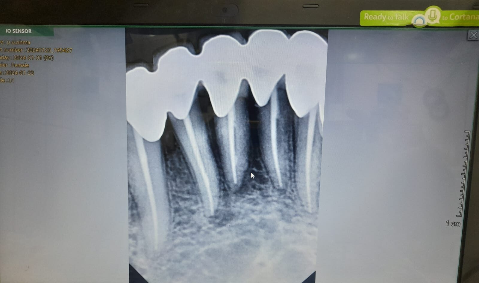 Best root canal treatment center