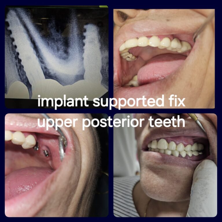 Advanced Dental Implant Center Dombivli