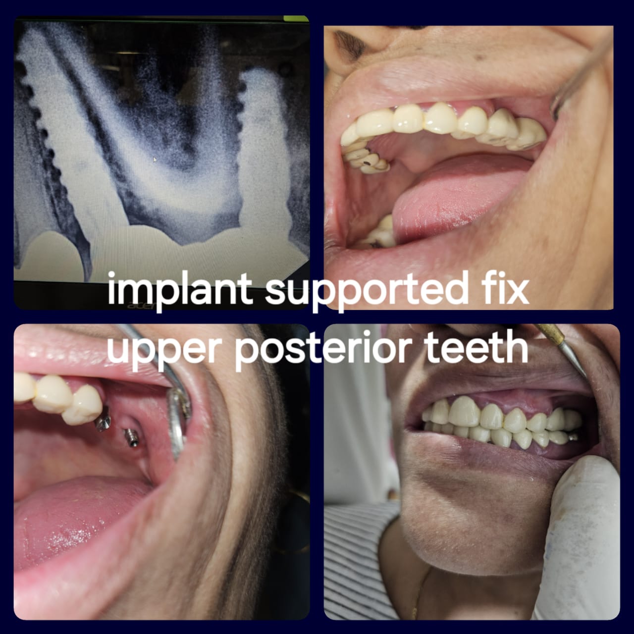 Advanced Dental Implant Center Dombivli