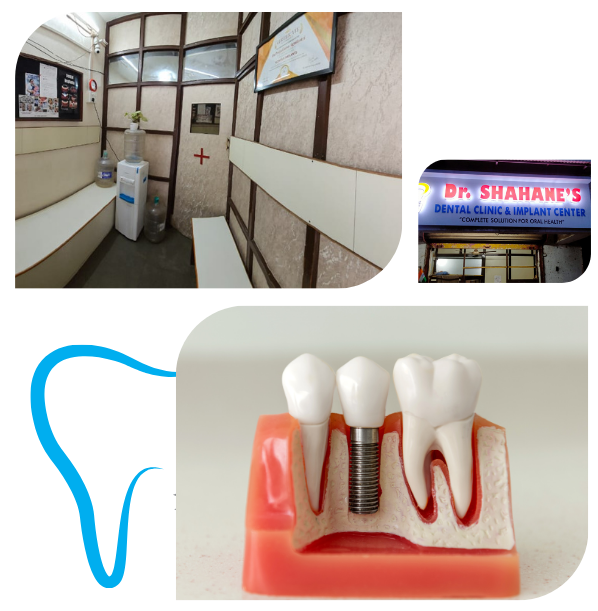 Best Dental Clinic in Dombivli